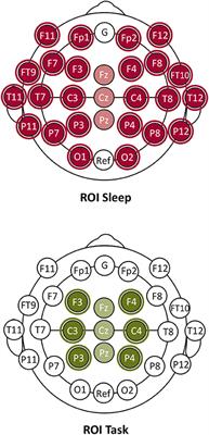 Pitfalls in Scalp High-Frequency Oscillation Detection From Long-Term EEG Monitoring